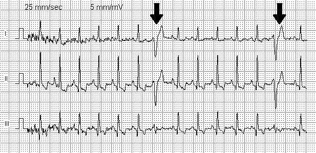 ECG of a dog