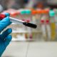 Blood sample in test tube